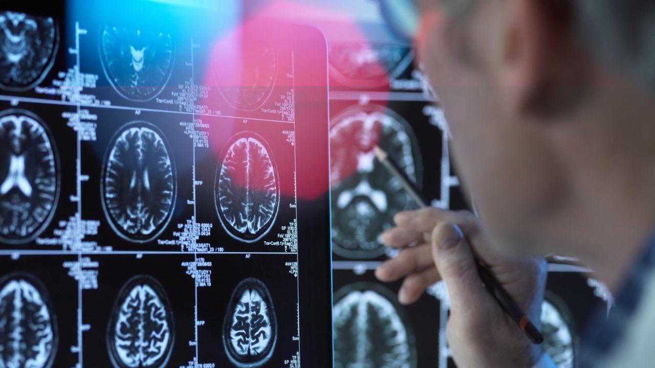 How Secure is Cloud Storage for Medical Imaging - Presented by PostDICOM